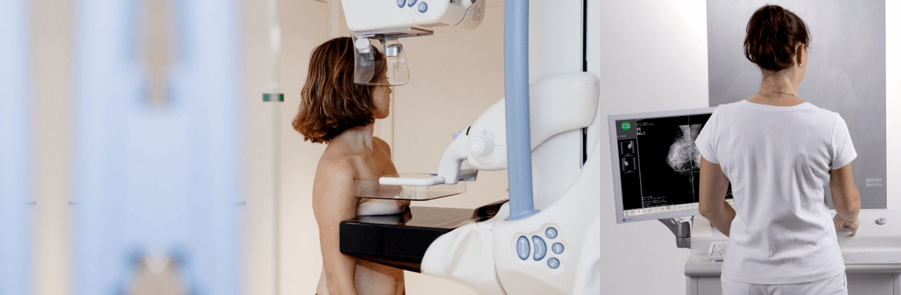 Маммографию после флюорографии. Рентген молочных желез маммография аппарат. Аппарат для цифровой маммографии молочных желез. Биоимпедансная маммография. Маммограф рентгеновский МАММОСКАН.